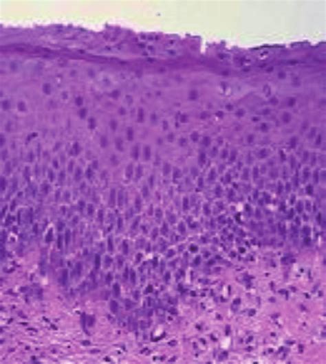Histological View Of Larynx Nonkeratinized Stratified Squamous