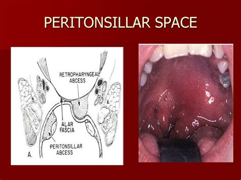 Surgical Fascial Spaces Online Presentation