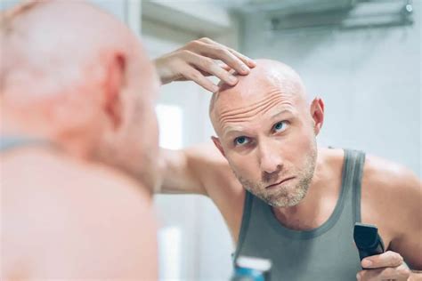 How To Treat Ingrown Hair On Scalp Easy Care Tips Bald And Beards