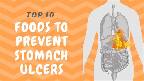 Cooking for the ulcer patient. 10 Foods to Prevent Stomach Ulcers - YouTube