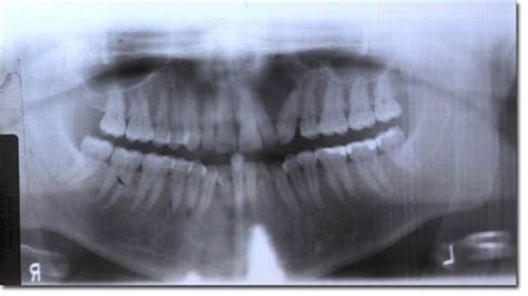 Com April 2006 Diagnosis Uw School Of Dentistry