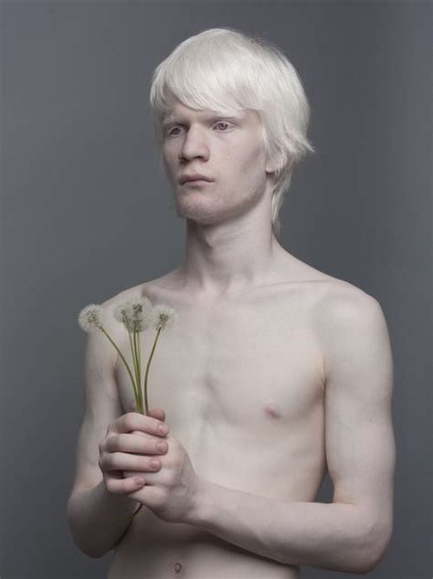 “different” Beauty Albino Models Who Are Changing The Fashion World