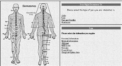 Dermatome Based Back Pain Locator Download Scientific Diagram