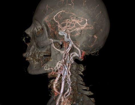 Thyroxine is the primary hormone discharged into a severe drop in body temperature is one effect of the administration of thyronamines. Revolution CT scanner reveals 'detailed' animated 4D ...