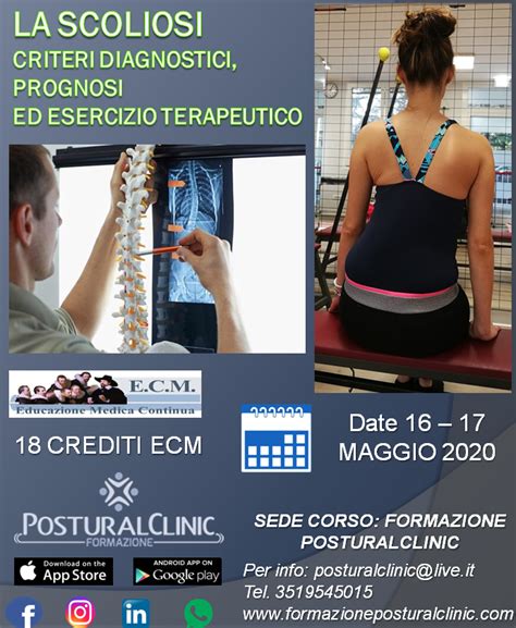 Scoliosi Posturalclinic Formazione Corsi Ecm Per Medici Odontoiatri