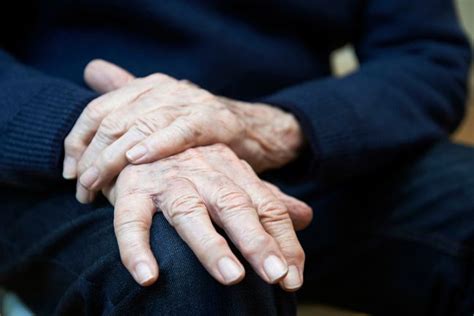 Choroba Parkinsona Parkinson Objawy Przyczyny Leczenie WP