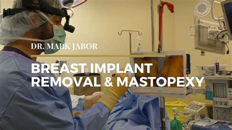 Chopra are highly trained plastic surgeons in beverly hills. Bilateral Implant Removal with Breast Lift | Dr. Mark Jabor - YouTube