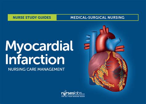 Myocardial Infarction Anatomy