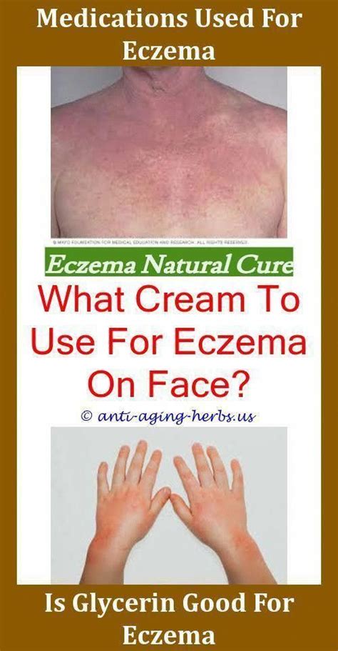 Medicaltreatmentforsnoring Eczema Treatment Get Rid Of Eczema Eczema