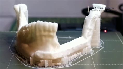 How To Print 3d Medical Models Youtube