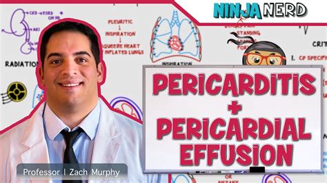 Pericarditis And Pericardial Effusion Youtube
