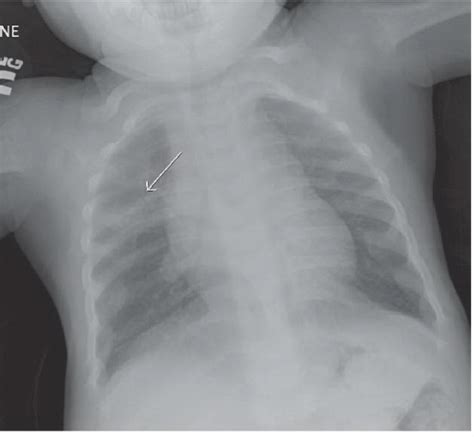 Pediatrics Radiology Key