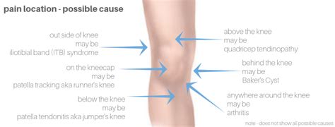 Arthritis knee pain centers 4040 e camelback rd, suite 155 phoenix, az 85018. knee pain - 6 problems that Bowen Therapy helps - Bowen ...
