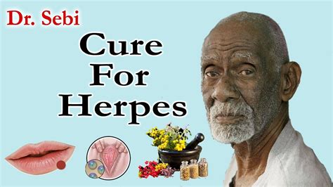 How Dr Sebi Cured Herpes Complete Guide To Dr Sebi Cure For Herpes