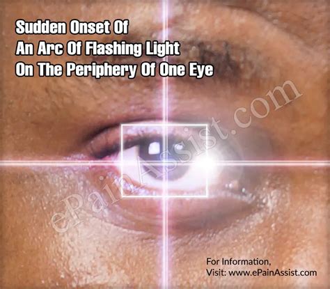 What Causes Sudden Flashing Lights In Eyes