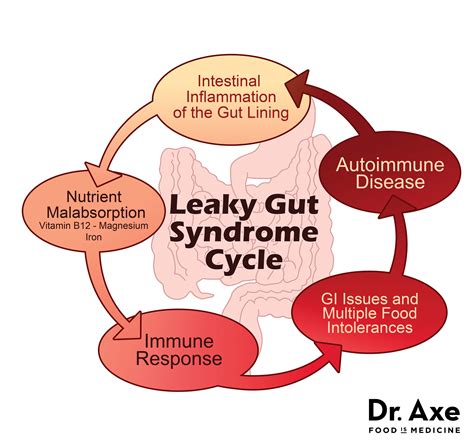 Heal Leaky Gut Syndrome And Autoimmune Disease Dr Axe