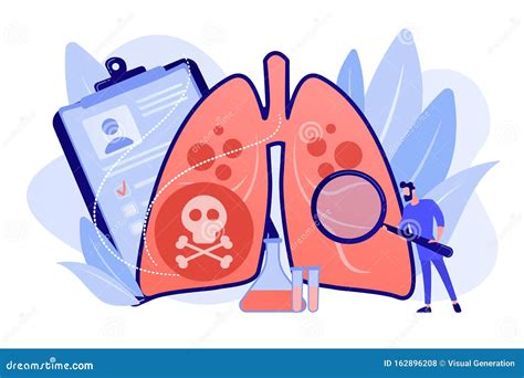 Ilustración Vectorial Del Concepto De Infecciones Respiratorias Bajas Ilustración del Vector