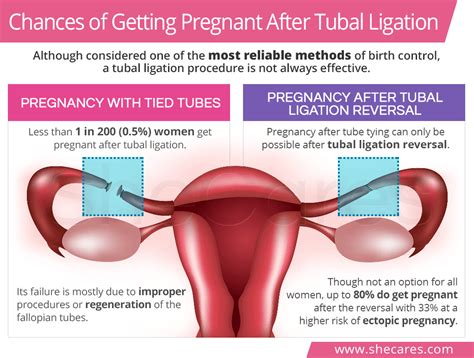Pregnancy Years After Tubal Ligation Renew Physical Therapy