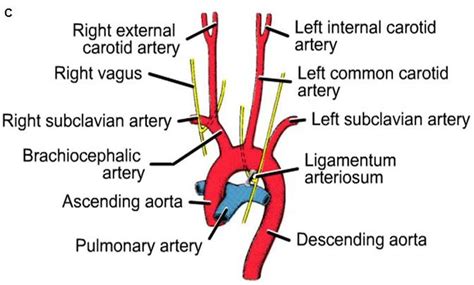Formation Of The Blood Vessels Arteries Cardiovascular System