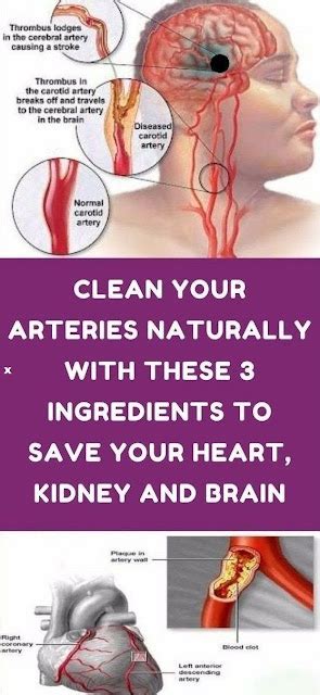 how to clean out plaque in arteries 3 ingredients mixture healhty
