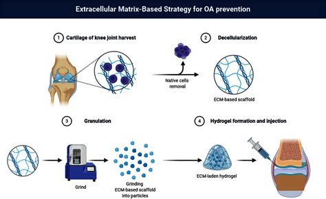 The Effect Of Cartilage Decellularized Extracellular Matrix Chitosan