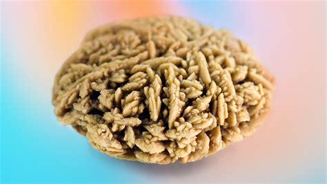 12 Facts About Kidney Stones Mental Floss