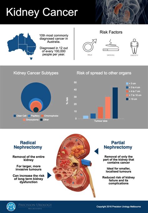 Precision Urology Melbourne Kidney Cancer