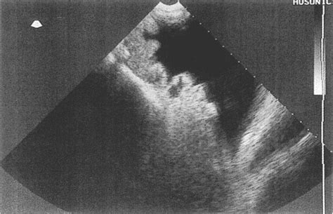 Ultrasonographic Examination Of The Caudal Abdomen Of A Wensleydale