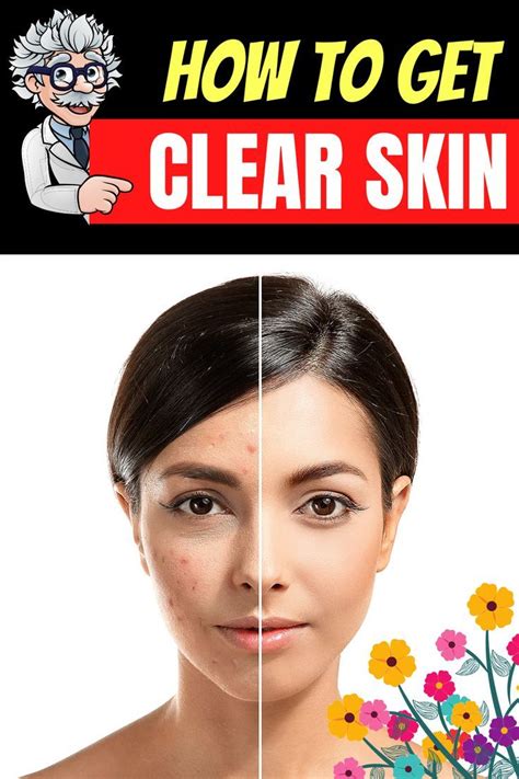 How To Get Clear Skin Overnight Naturally At Home Get Rid Of Pimples