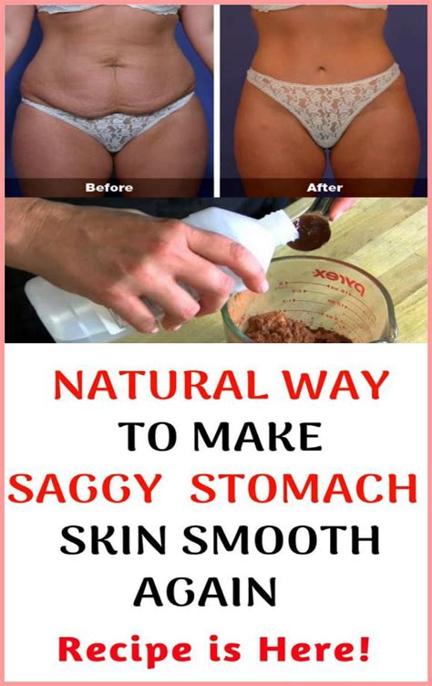 How To Make Your Saggy Stomach Skin Smooth Naturally Tighten Stomach