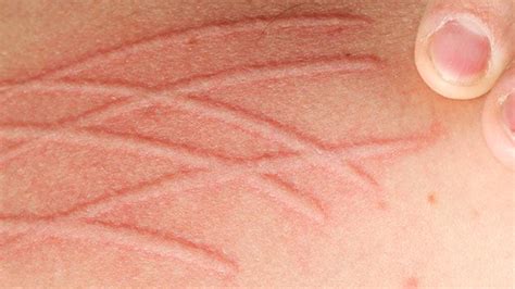 Itching Whats Causing Your Itchy Skin With Pictures