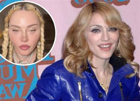 madonna plastic surgery daily mail everything you should know on plastic surgery of madonna