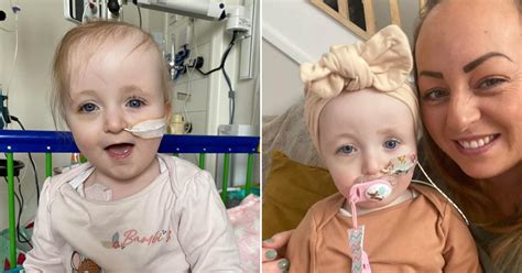 Mothers Warning After Babys Bruise Turns Out To Be Stage 4 Cancer