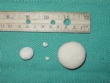 Low numbers of struvite crystals are considered normal for some dogs and cats. Bladder stone (animal) - Wikipedia