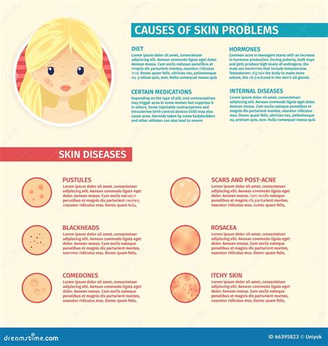 Infographics Of Skin Problems The Causes Of Problem Skin Types Of