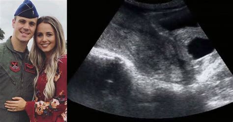 Woman Shares How Her 8 Week Ultrasound Revealed A Miscarriage