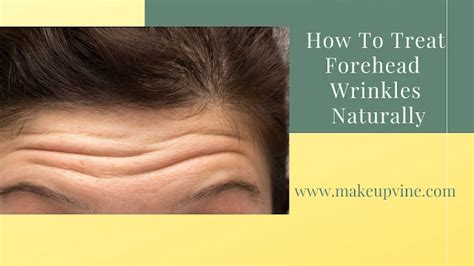 How To Treat Forehead Wrinkles Naturally Makeup Vine