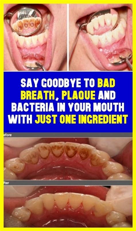 tell goodbye to bad breath in your mouth plaque and bacteria bad