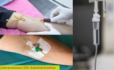 Intravenous Injection Sites Uses Equipment Iv Push Iv Infusion And Complications