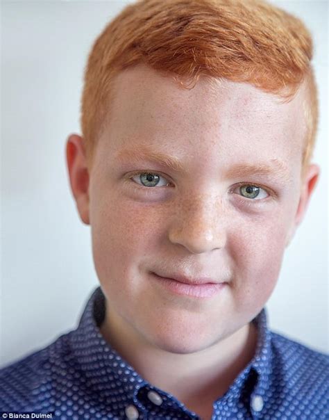 Bianca Duimel Photographs Redheads To Spread Anti Bullying Message