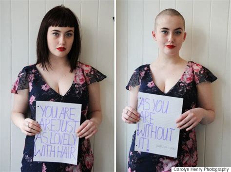 Body Image Blogger Shaves Head For Cancer Awareness To