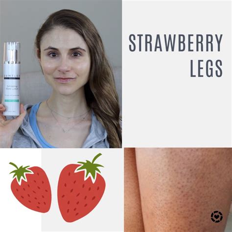 Get Rid Of Strawberry Legs Strawberry Legs Products For Strawberry