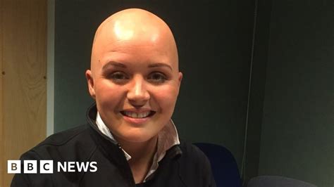 Shaving Head Gave Me Control Says Ni Alopecia Sufferer Bbc News