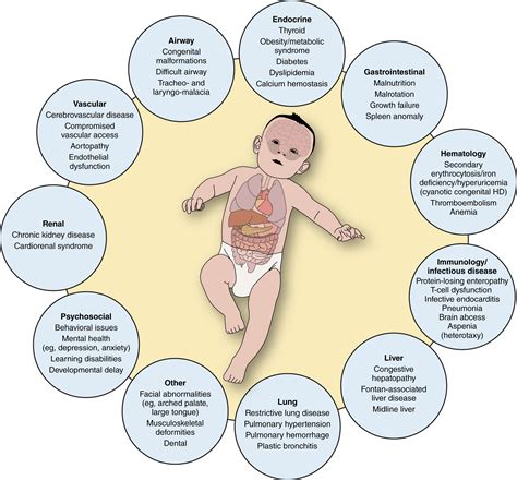 Perioperative Considerations For Pediatric Patients With Congenital