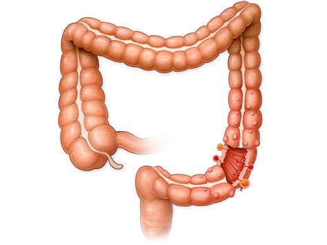 An appendix should be created on its own individual page labelled appendices should be formatted in traditional paragraph style and may incorporate text, figures. Why do we have an appendix? Scientists have discovered its purpose and it's really important ...