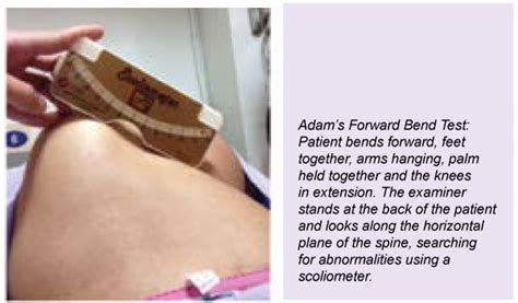 The adams forward bend test is used in many situations to diagnose scoliosis however it is not a primary source for a diagnosis this test is often used at s. Overcoming Scoliosis - Positive Parenting