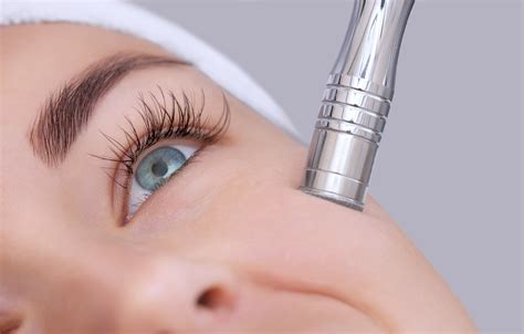 Everything You Need To Know About Microdermabrasion Treatment
