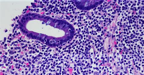 They have in common, generally speaking, biological changes that favour the survival. A to Z List of Cancer Types - National Cancer Institute