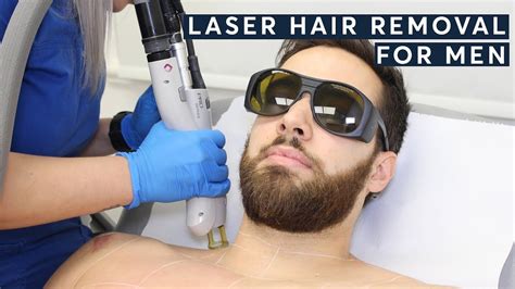 Laser Hair Removal For Men Over 40 Of Our Clients Are Men Youtube
