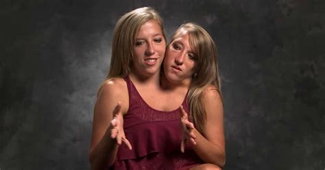 najsłynniejsze bliźniaczki syjamskie świata chcą żyć normalnie kobieta